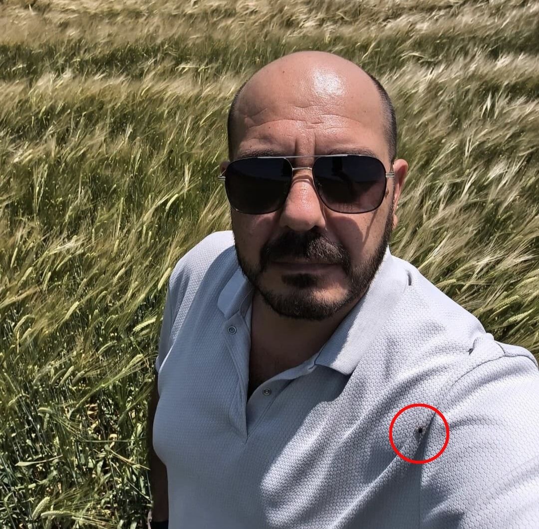 Tarlada Selfie Çekti, Üzerinde 20’Den Fazla Kene Olduğunu Fark Etti (4)