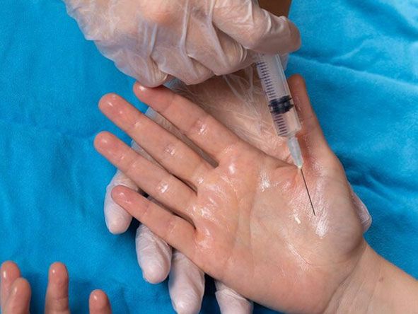 Ter Bezi Botoksu Nedir, Nasıl Yapılır Ve Kalıcı Mıdır Aşırı Terlemeye Karşı En Etkili Yöntem Midir (1)