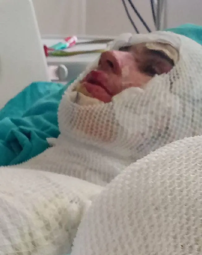 Yeğenini Diri Diri Yakan Amca, Suçu Ağabeyine Attı! (5)