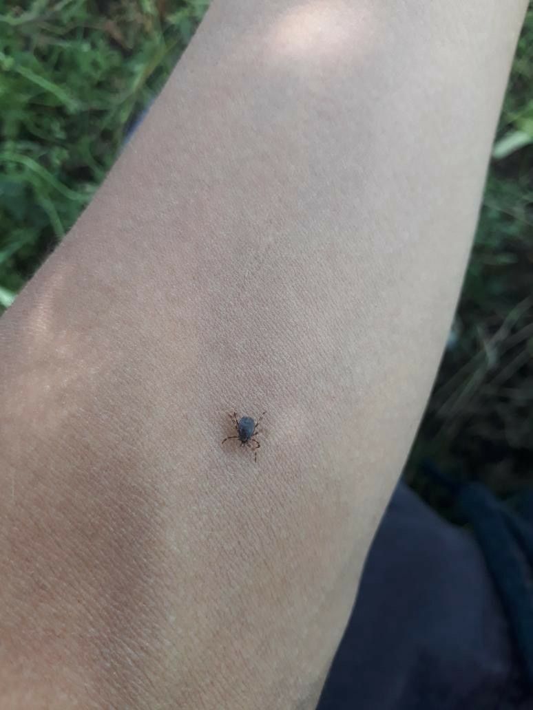 Bolu'da Kene Isırması Sonucu 77 Yaşındaki Kadın Hayatını Kaybetti (1)