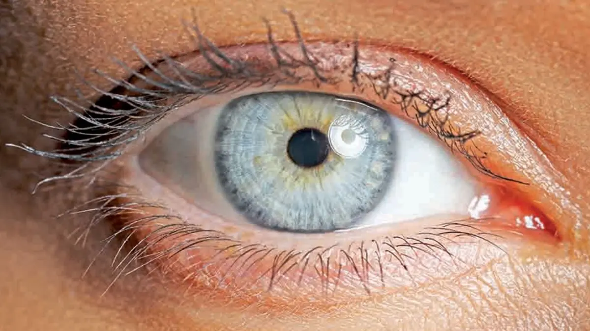 T25 Goz Bebegi Boyutunun Zeka 385