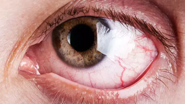 5F1Fc5E25542812028Fefe34