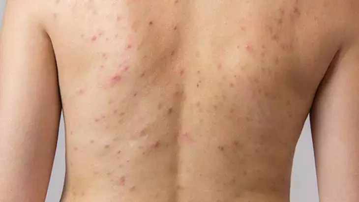 5F4D02Ab55428411544D72F1