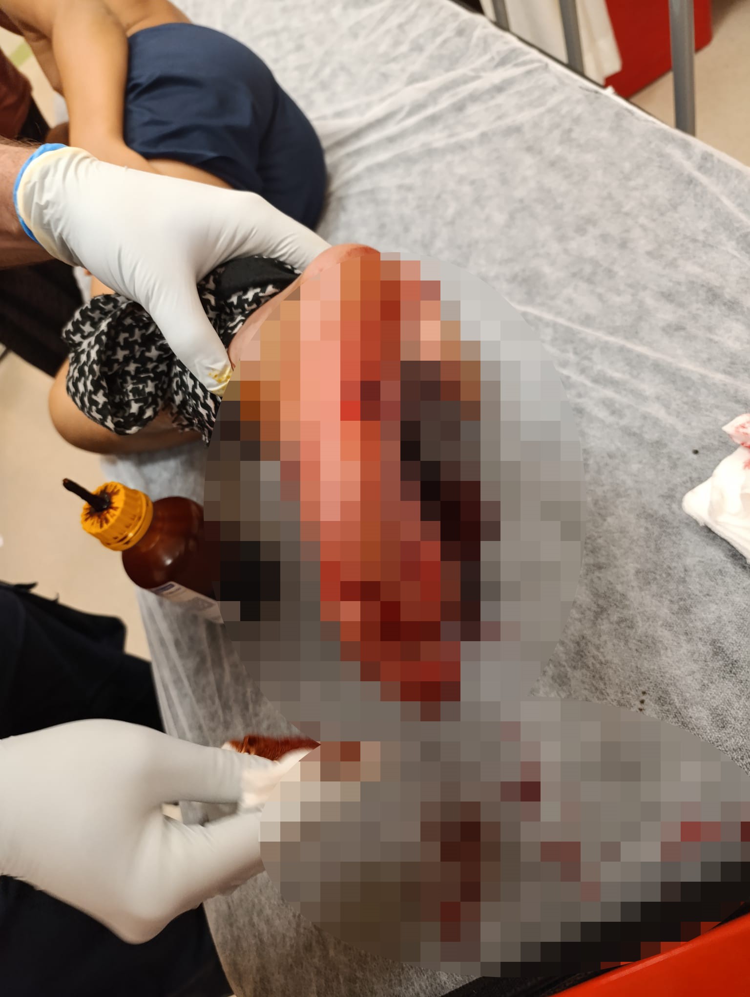 Balkonda Oturan Çocuğa Kurşun Isabet Etti (1)