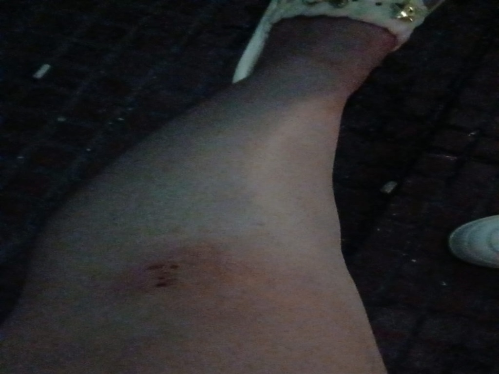 Genç Gazete Bursa’da 2 Çocuğunu Teslim Etmek İstediği Eski Eşi Tarafından Darbedildi 3