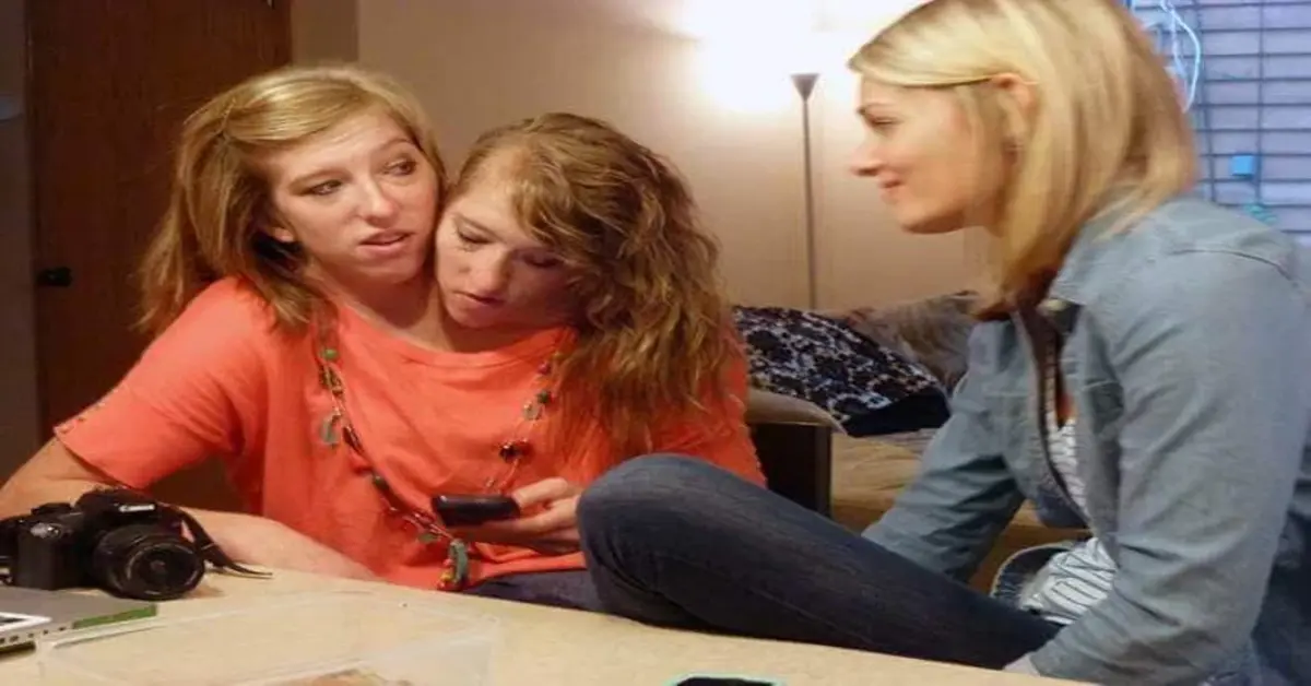 Genç Gazete Doktorlar ‘Uzun Yaşayamazlar’ Demişti Yapışık İkizler Anne Oldu 1