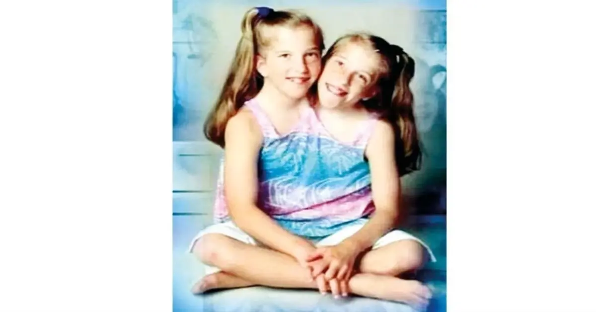 Genç Gazete Doktorlar ‘Uzun Yaşayamazlar’ Demişti Yapışık İkizler Anne Oldu 2