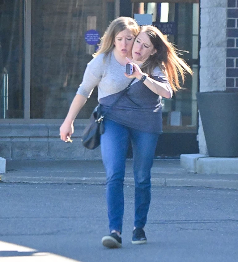 Genç Gazete Doktorlar ‘Uzun Yaşayamazlar’ Demişti Yapışık İkizler Anne Oldu 4