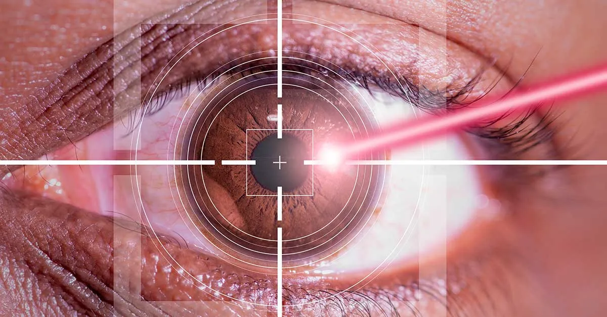 Göz Çizdirme Ameliyatı 3 Gencgazete