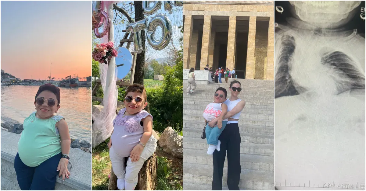 İnegöl’de 30 Yaşındaki Kadının Karnından 3 Kilo Kist Çıkarıldı (5)