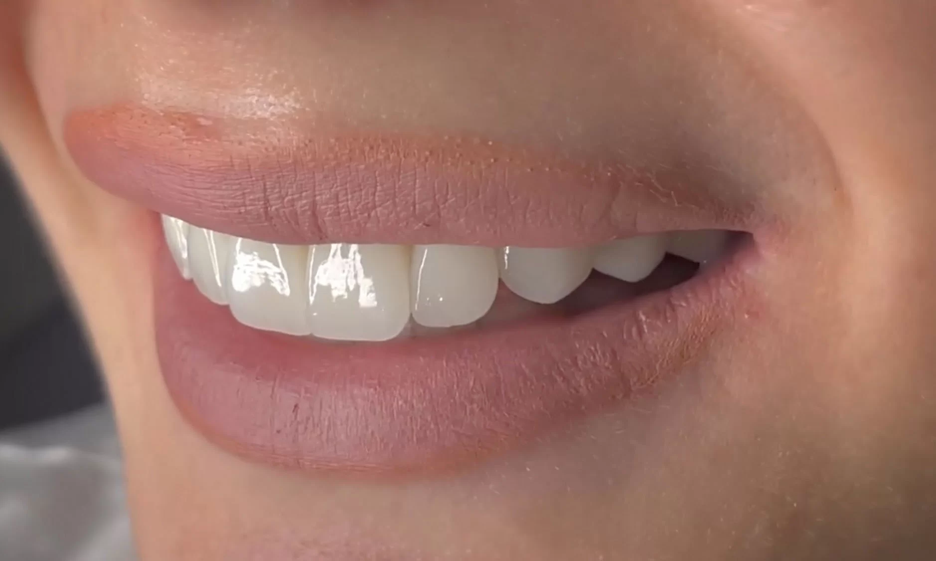 Merak Ettikleriniz Drsemihyazici 1