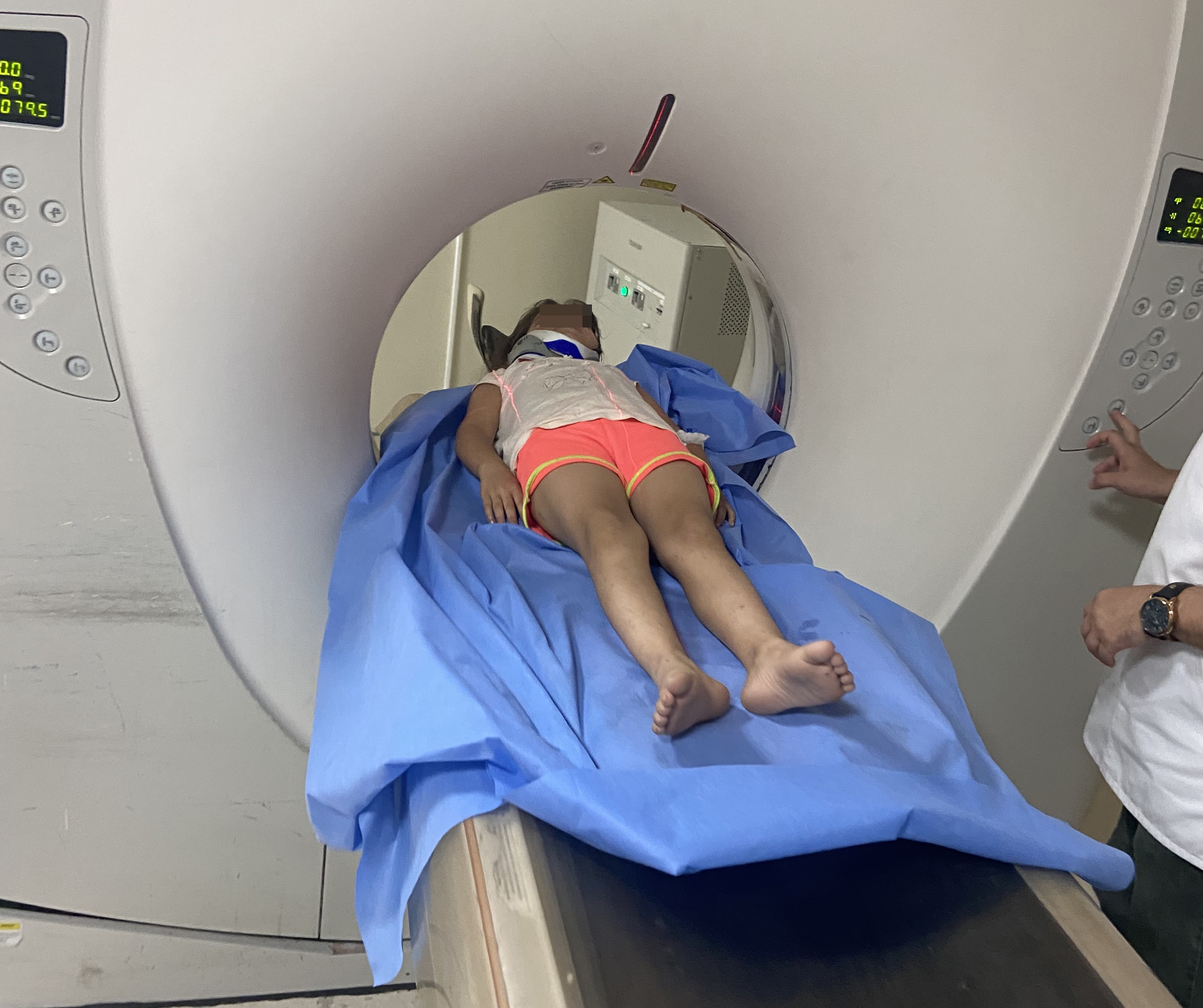 Ordu'da Ters Şeritten Gelen Scooter, 8 Yaşındaki Çocuğa Çarptı (1)