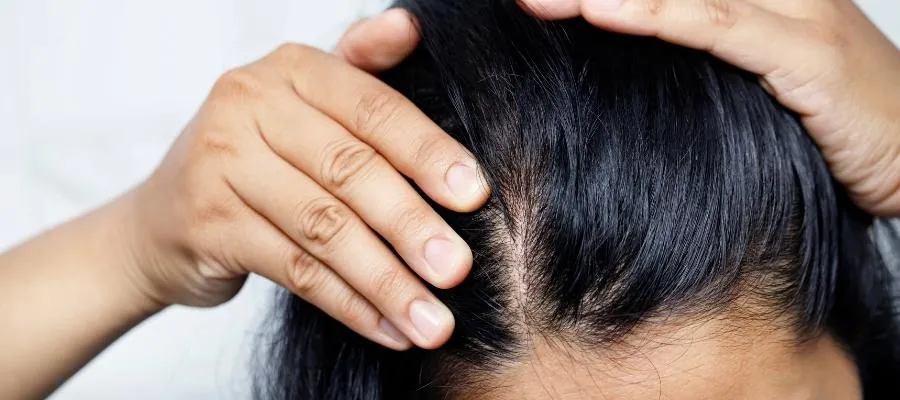 Sac Mantari Nasil Olur 2