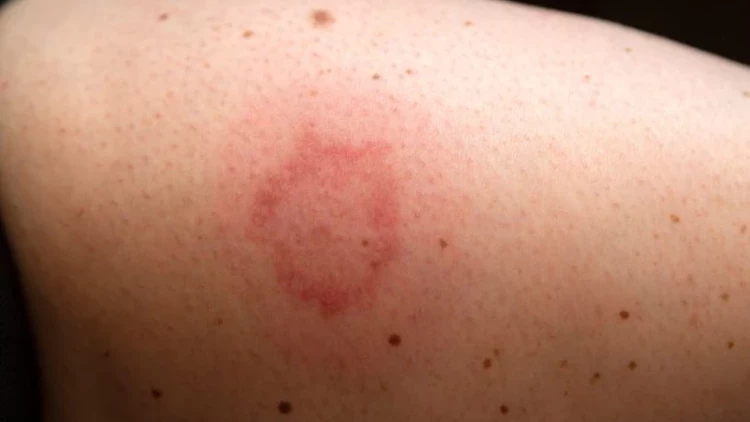 602Fb534C9De3D2Ffc1E2Ae7