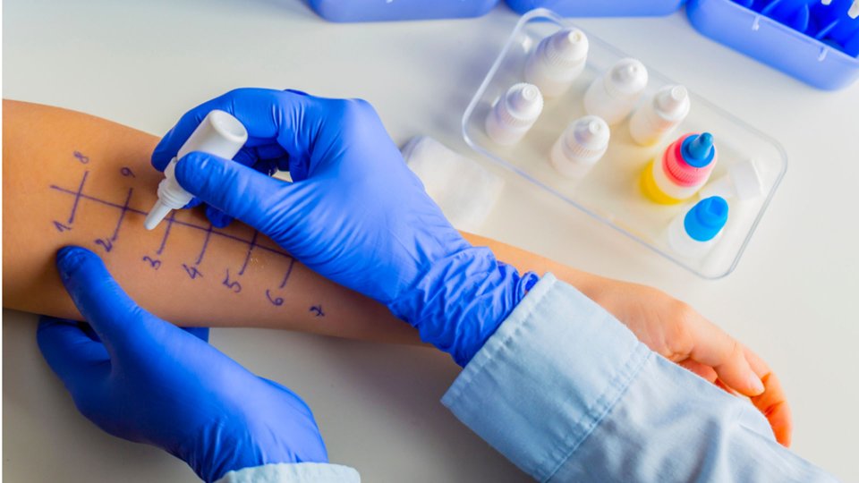 Alerji Belirtilerinde Bu Testler Hayat Kurtarıyor (1)