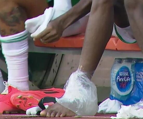 Osimhen Sakatlandı Genç