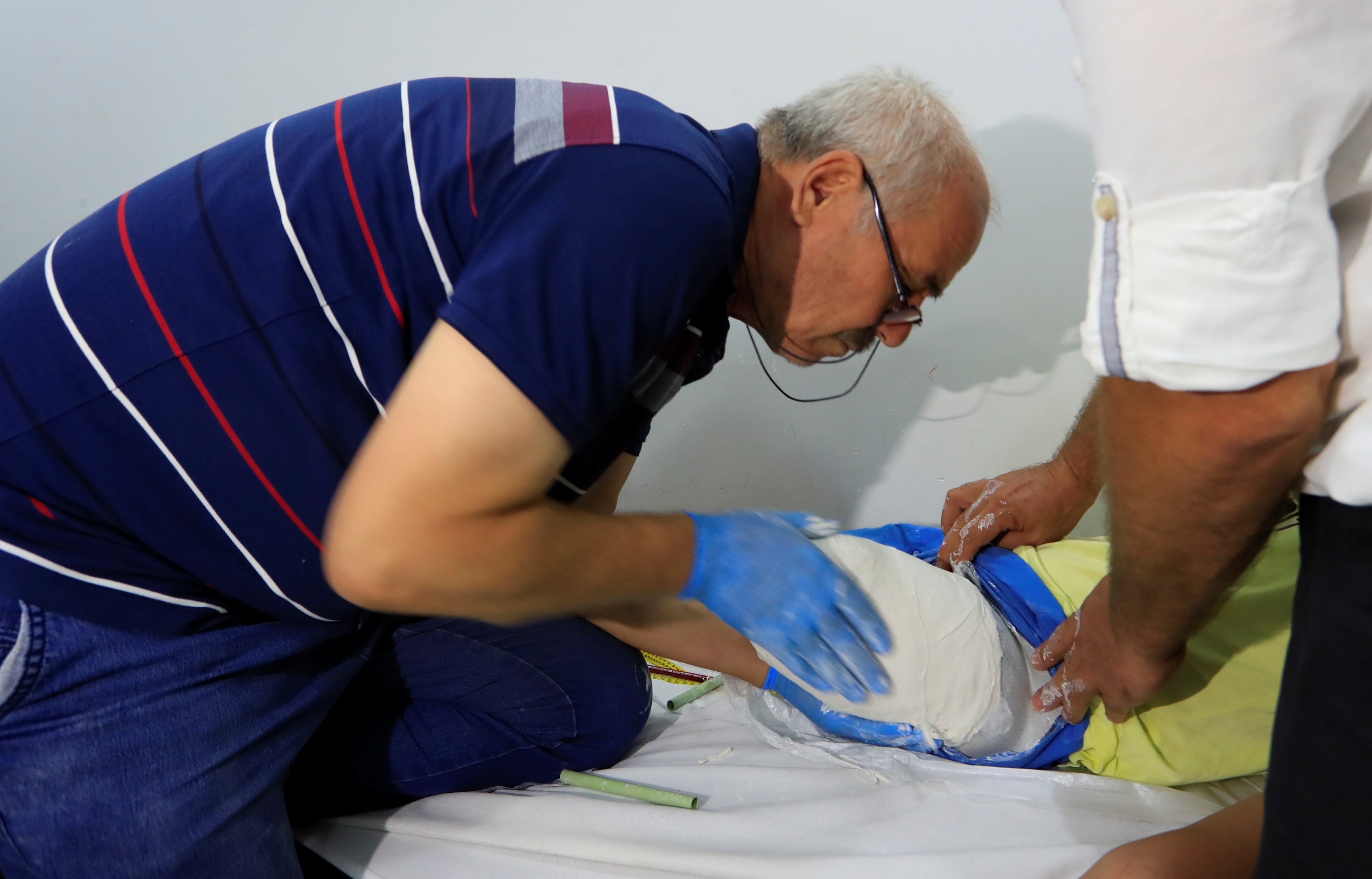 Özge Protezine Kavuşuyor Gencgazete (1)