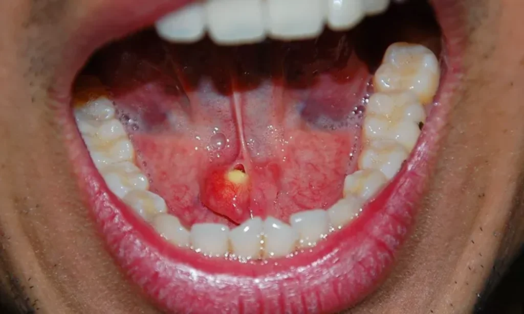 Tukuruk Bezi 2 1024X615