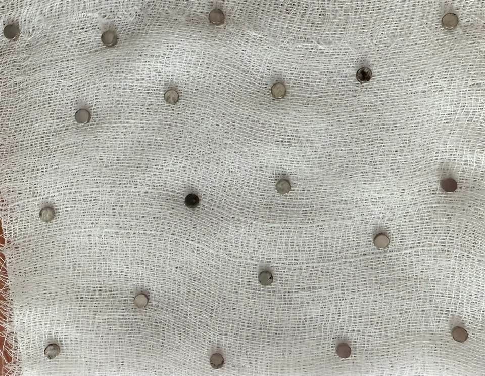 3 Yaşındaki Çocuğun Boğazından 19 Mıknatıs Gencgazete (1)