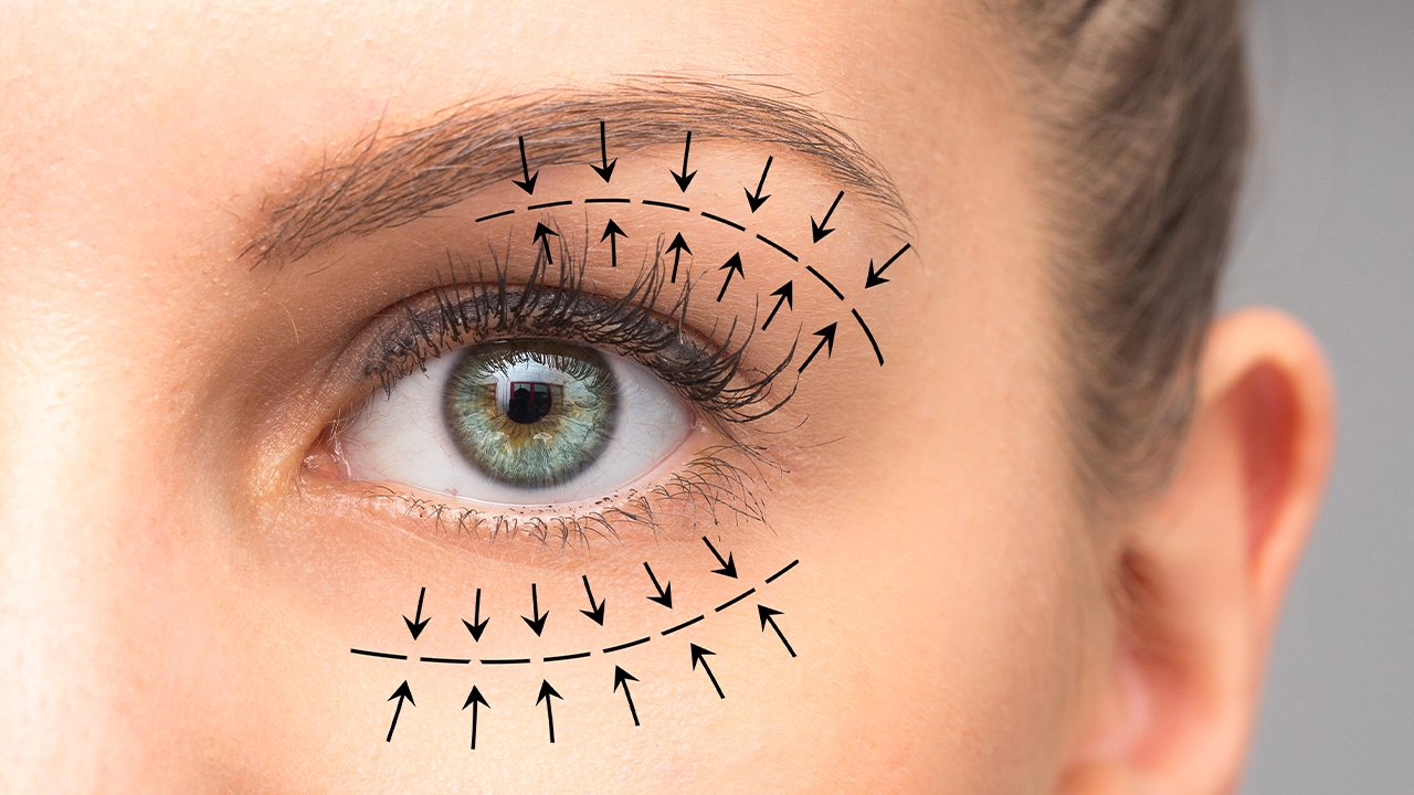 Amaliyatsiz Goz Kapagi Estetigi Fiyatlari