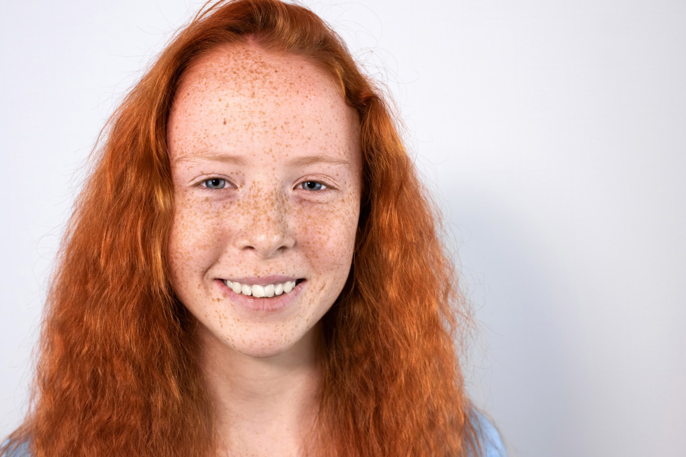 Çil Nedir, Neden Olur Ve Nasıl Geçer Gencgazete (16)