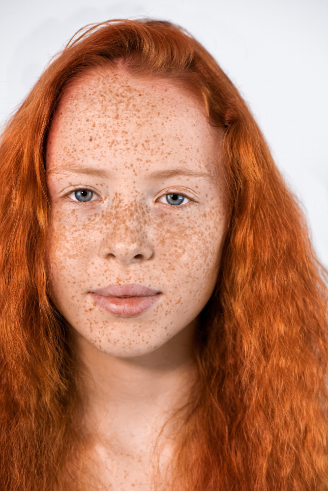 Çil Nedir, Neden Olur Ve Nasıl Geçer Gencgazete (17)