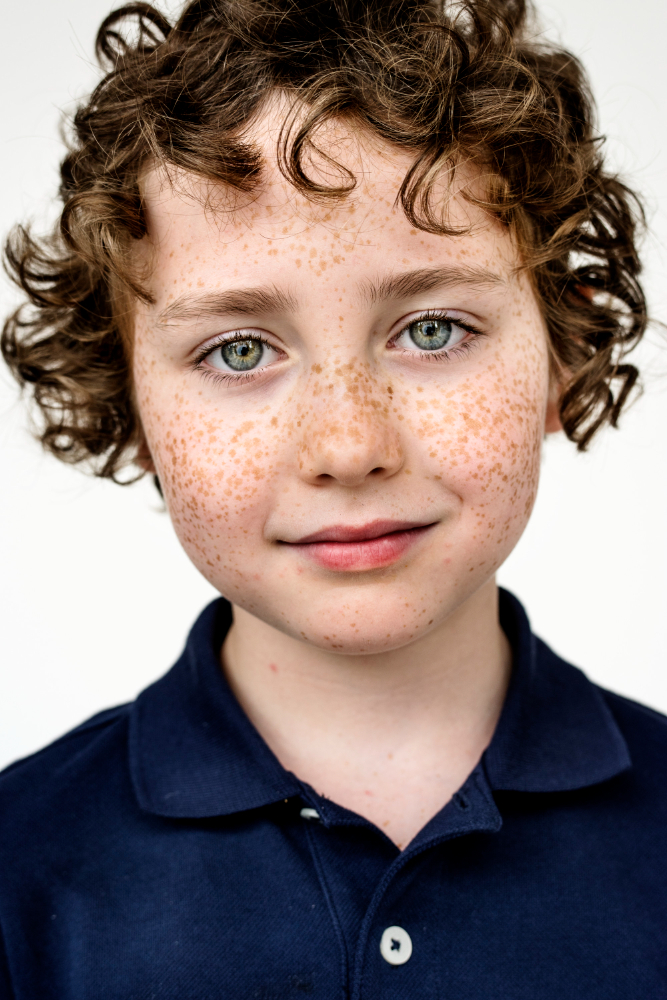 Çil Nedir, Neden Olur Ve Nasıl Geçer Gencgazete (2)