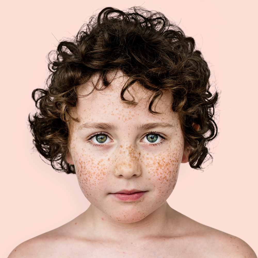 Çil Nedir, Neden Olur Ve Nasıl Geçer Gencgazete (4)