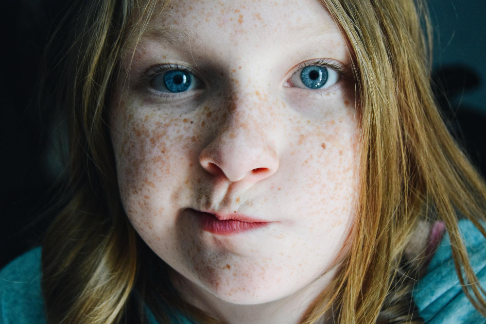 Çil Nedir, Neden Olur Ve Nasıl Geçer Gencgazete (5)