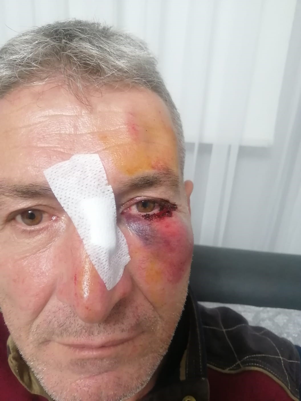 İnegöl'de Komşularını Canından Bezdirdi (2)