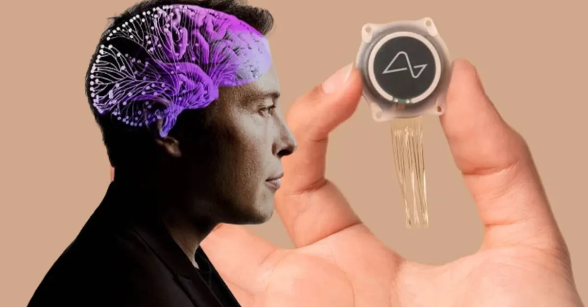 Yalnızca Düşünerek Telefon Kullanmak Artık Mümkün! Beyin Çipi Teknolojisinde Devrim Niteliğinde Gelişme (6)