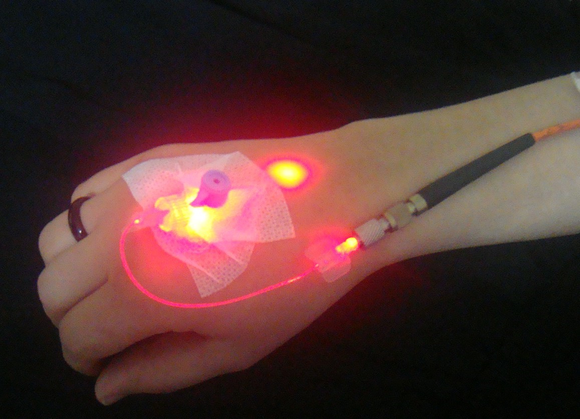 Bir Ayağınızın Numarası Diğerinden Büyükse Dikkat (1)