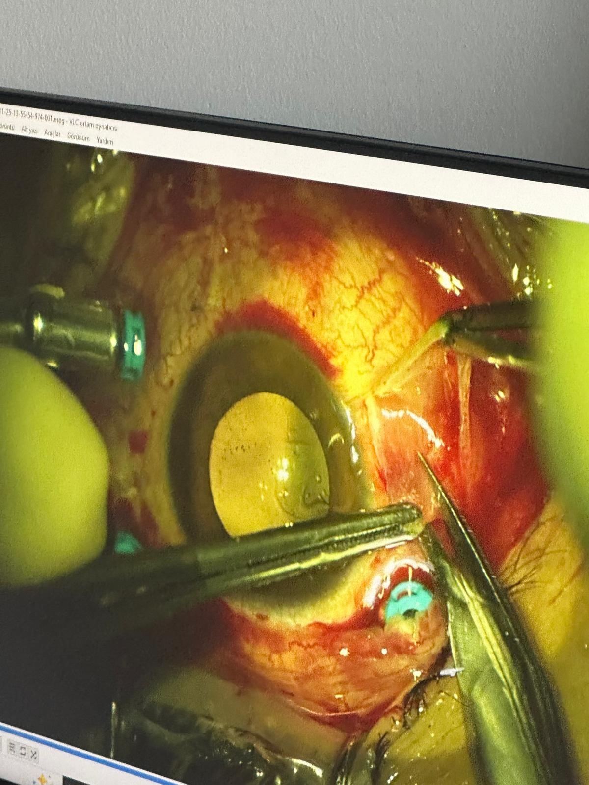 Damadını Gözünden Vurdu (3)