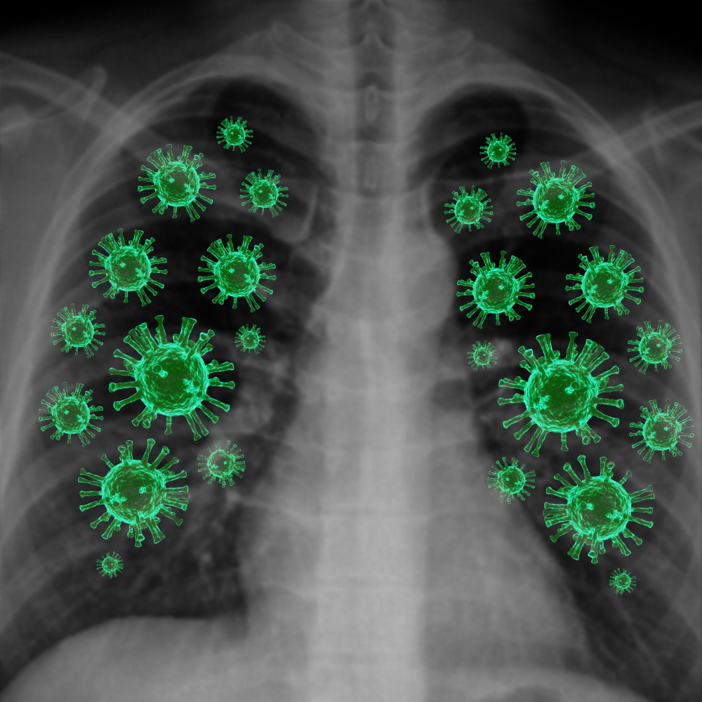 Dünya Pnömoni (Zatürre) Günü 12 Kasım Günü Gencgazete (10)