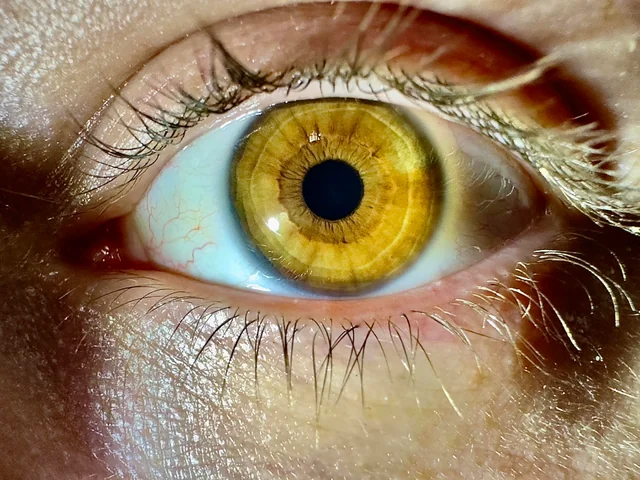 Göz Rengi Zamanla Değişir Mi Bu Durum Hangi Faktörlerden Kaynaklanıyor (1)