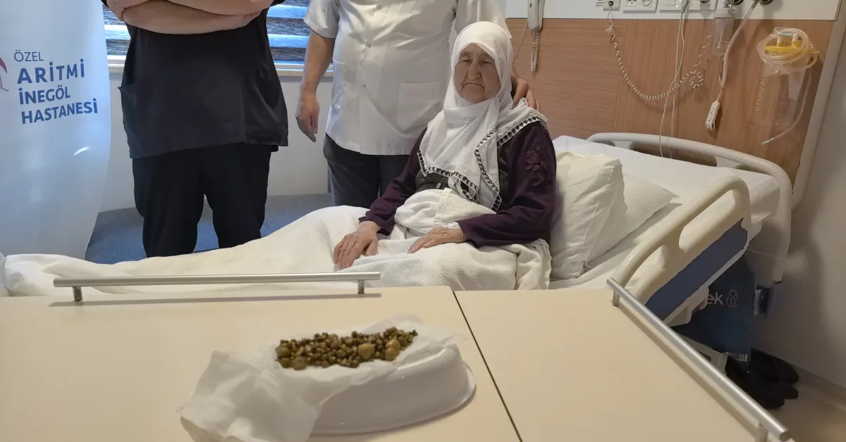 İnegöl’de Safra Kesesinden 213 Taş Çıkarıldı (1)