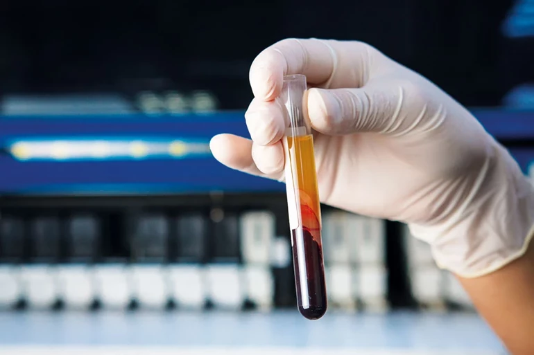 61858Bea4E3Fe01684C93Ff5