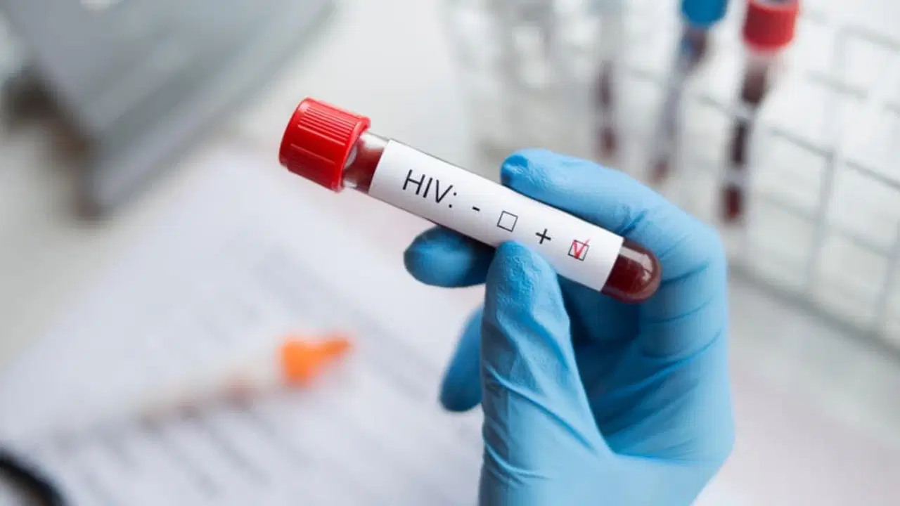 Gelecek 10 Yılda Hiv Nedeniyle Milyonlarca Kişi Ölebilir! Uzmanlar Neden Alarm Veriyor, Risk Ne Kadar Büyük (1)-1