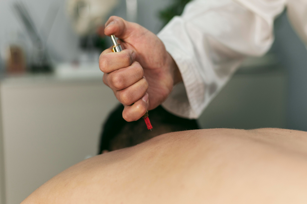 Akupunktur Nedir, Ne İşe Yarar Gencgazete (5)