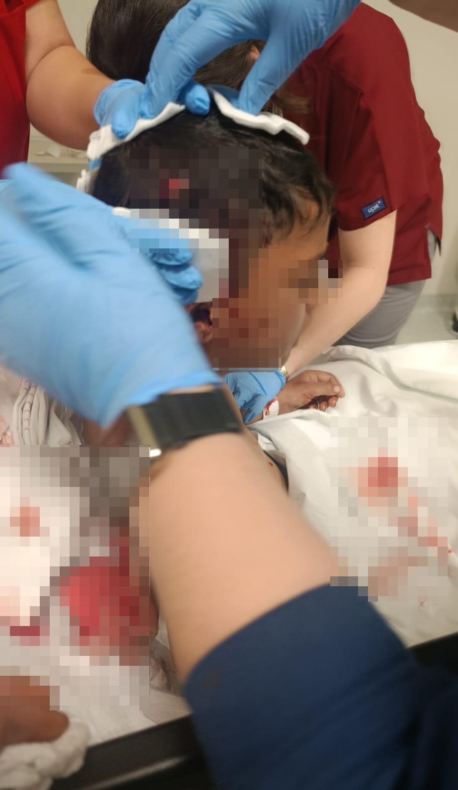 Ankara’nın Altındağ Ilçesinde Okuldan Evine Dönen 8 Yaşındaki Çocuk, Başıboş Köpeğin Saldırısı Sonucu Yaralandı. Çocuğun Sağlık Durumunun Iyi Olduğu Öğrenildi (1)