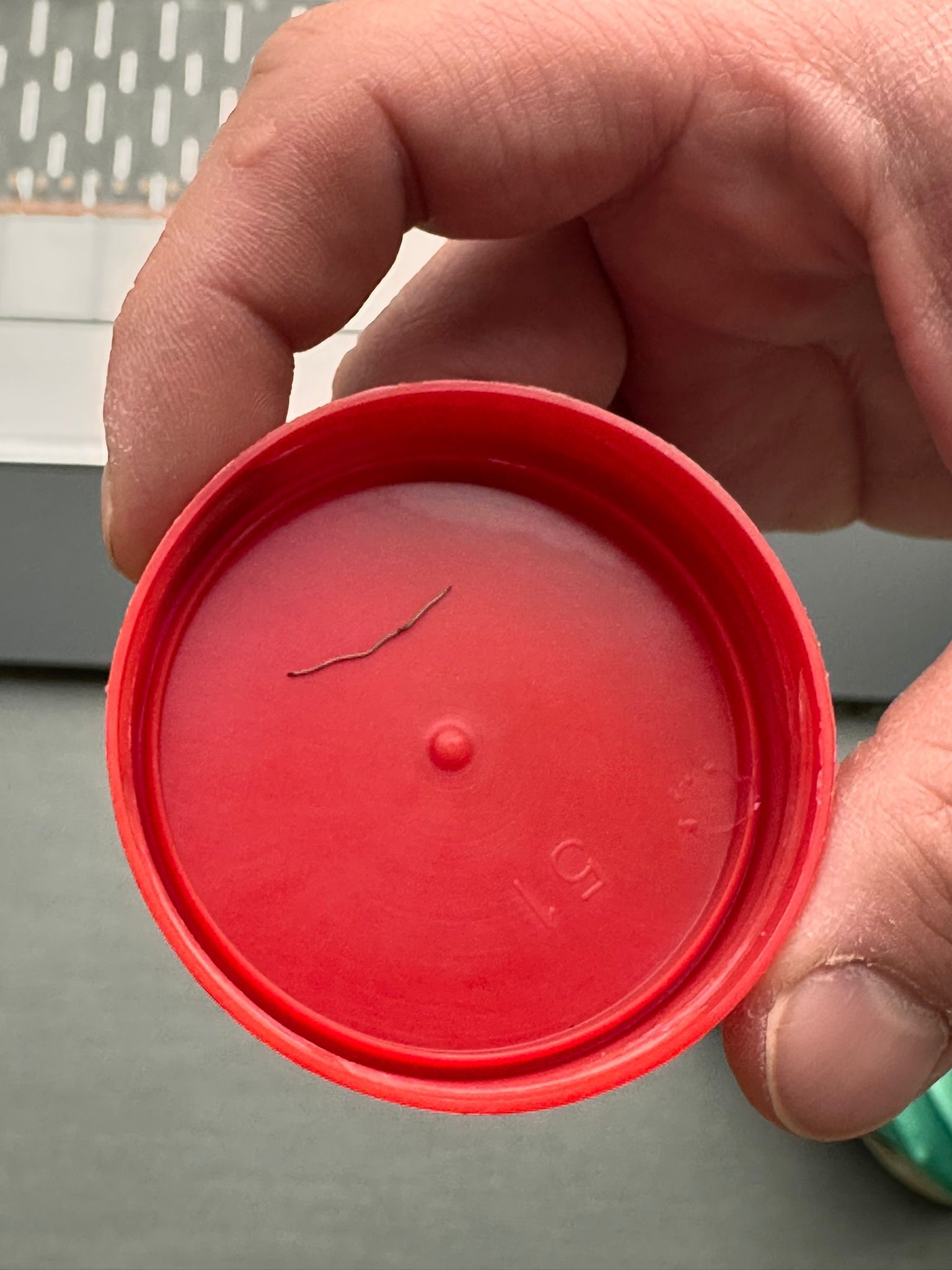 Bebeğin Sırtından Tel Parçası Çıktı (3)