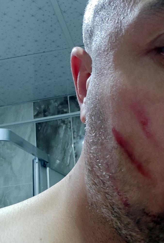 Bursa'da Yolunda Ortasında Çıkan Kavganın Nedeni Yok Artık Dedirtti! (3)