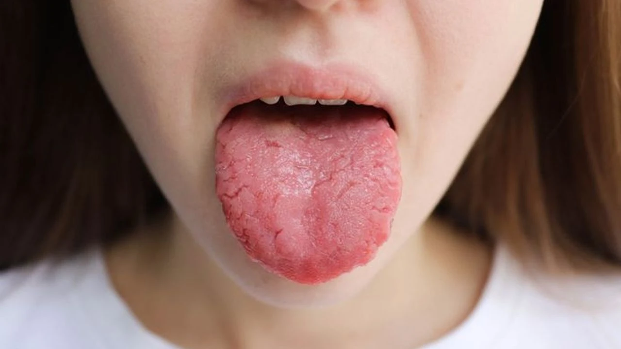 Dilinizde Harita Gibi Lekeler Mi Var, Harita Dil Nedir, Neden Ortaya Çıkar Ve Ne Zaman Ciddiye Alınmalı (2)-1