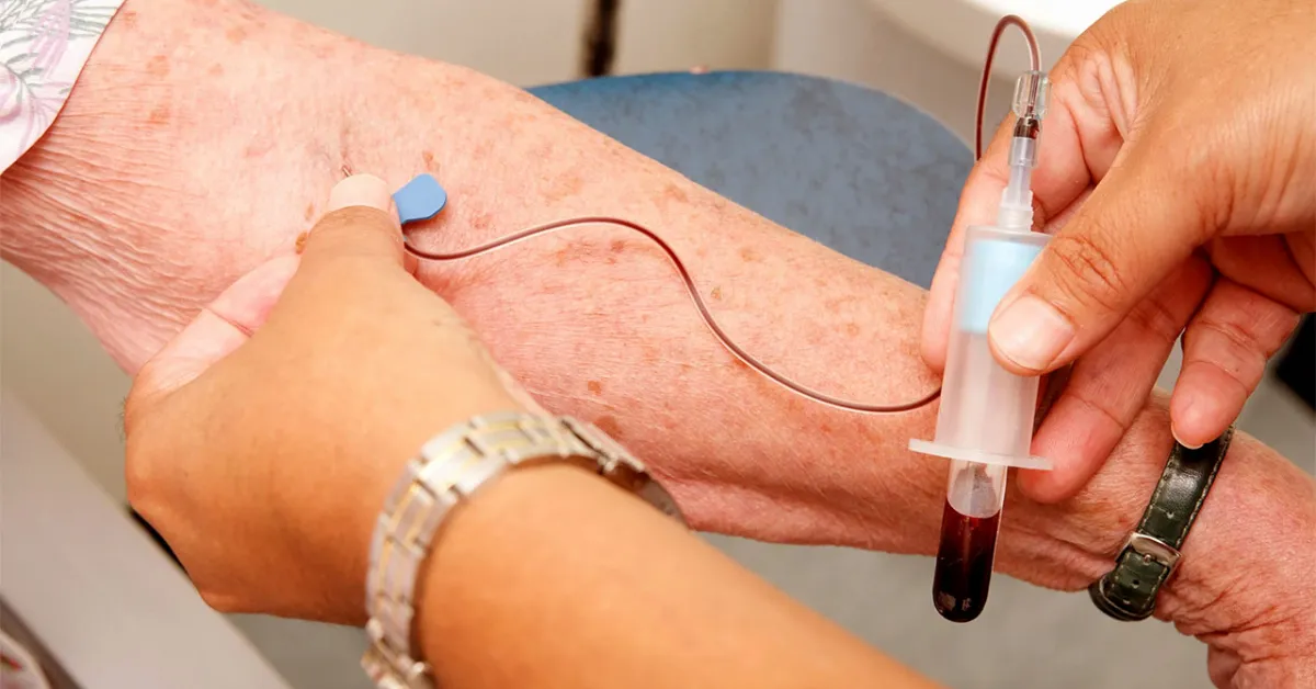 Tek Bir Kan Testiyle Alzheimer Yıllar Öncesinden Yakalanabilir Mi Gencgazete