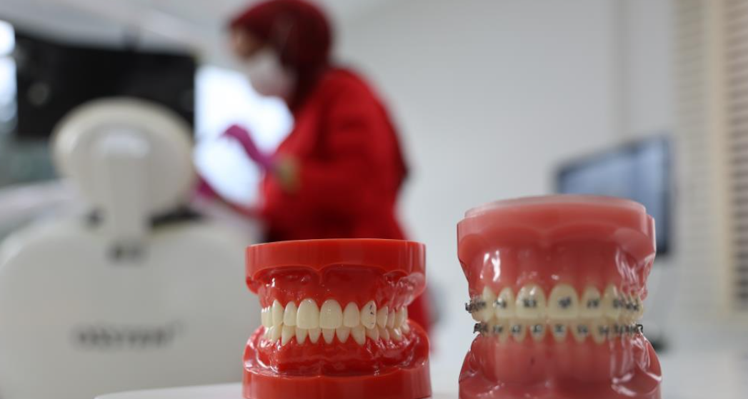 Diş Hekiminden Uyarı, Iftardan Sahura Bardak Bardak Çay Içenler Dikkat (2)