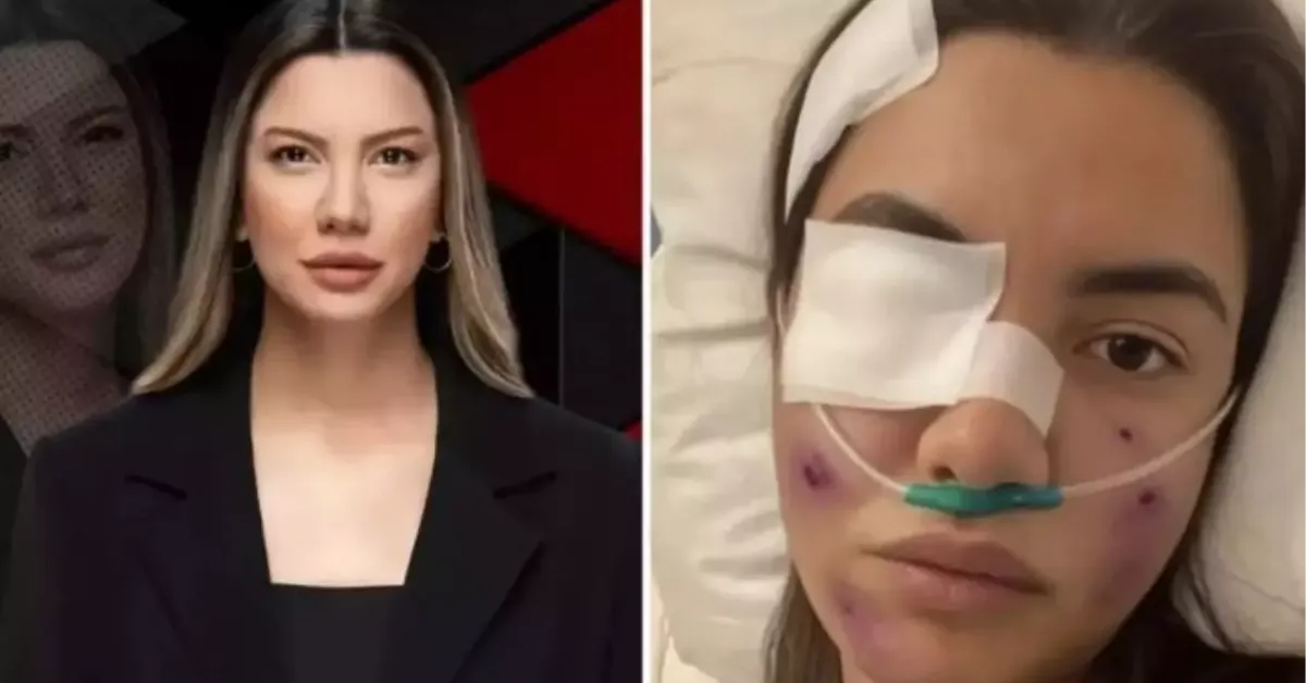 Fulya Öztürk Trafik Kazası Mı Geçirdi Fulya Öztürk'ün Durumu Nasıl Fulya Öztürk Kimdir, Nereli, Kaç Yaşında (2)