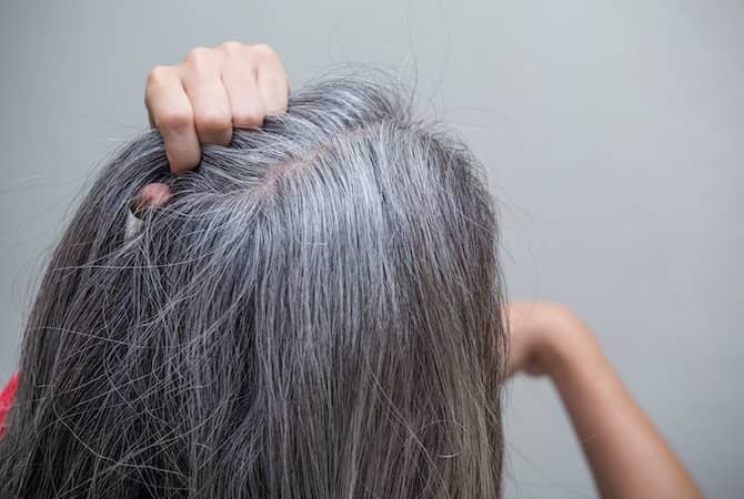 Saç Beyazlamasını Yavaşlattığı Söylenen 2 Balık Türü Hangileri, Erken Beyazlara Karşı Gerçekten Etkili Mi-1