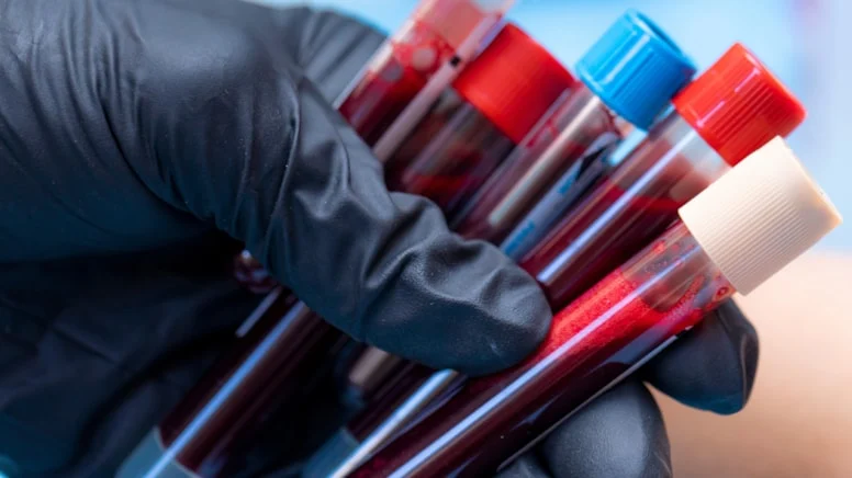 Tek Tüp Kanla Hayat Süresi Tahmini! Bilim İnsanları Şaşırtan Sonucu Açıkladı (1)-1