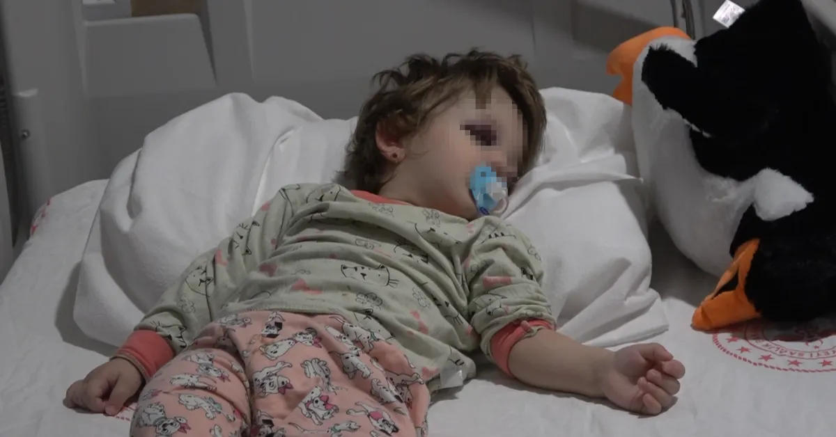 Yalova’da Komşu Kavgası Babanın Burnu, 14 Aylık Bebeğin Kafatası Çatladı (2)