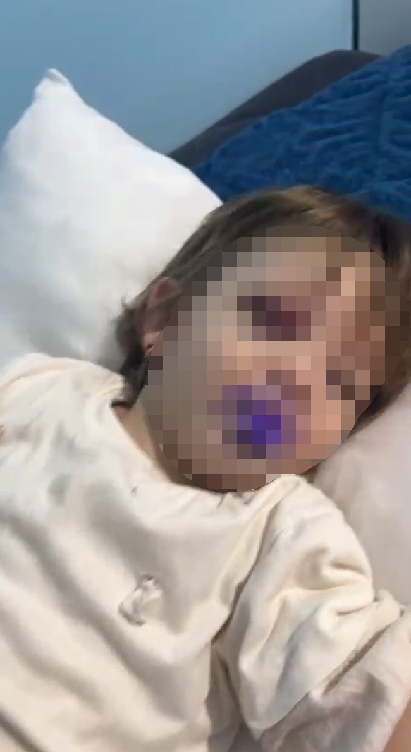 Yalova’da Komşu Kavgasında Yaralanan 14 Aylık Bebek Taburcu Edildi (1)